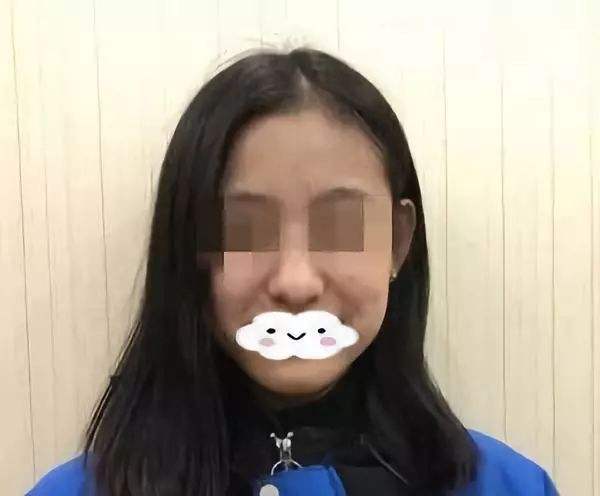 隆鼻修復.jpg