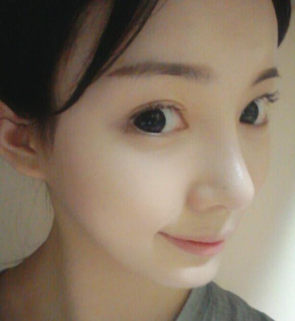 鼻假體.jpg