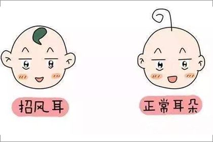 招風耳.jpg