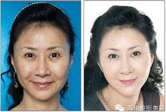 提升膚質.jpg