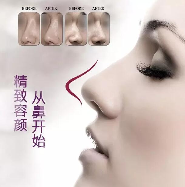 精致容顏，從鼻開始