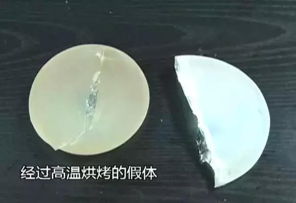 假體豐胸手術(shù).jpg