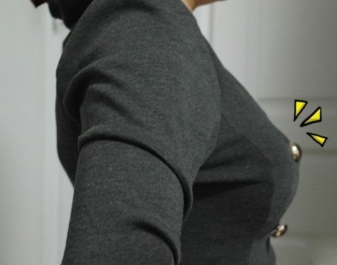 乳房矯正.jpg