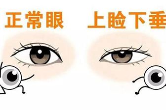 矯正手術.jpg