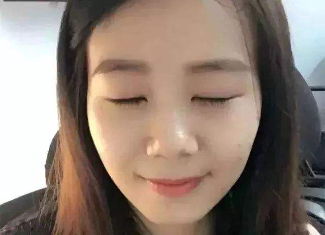 下垂手術.jpg